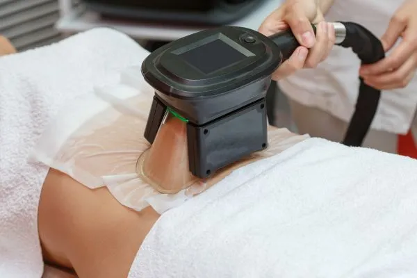 Image of person having fat freezing treatment to help weight gain Bishopbriggs