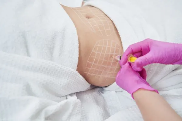image of fat dissolving injections on love handles to help combat weight gain Bishopbriggs