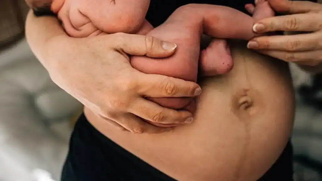 Why Is My Stomach Still Big After Pregnancy Bishopbriggs?